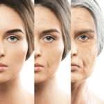 tra-rejuvenecimiento-p