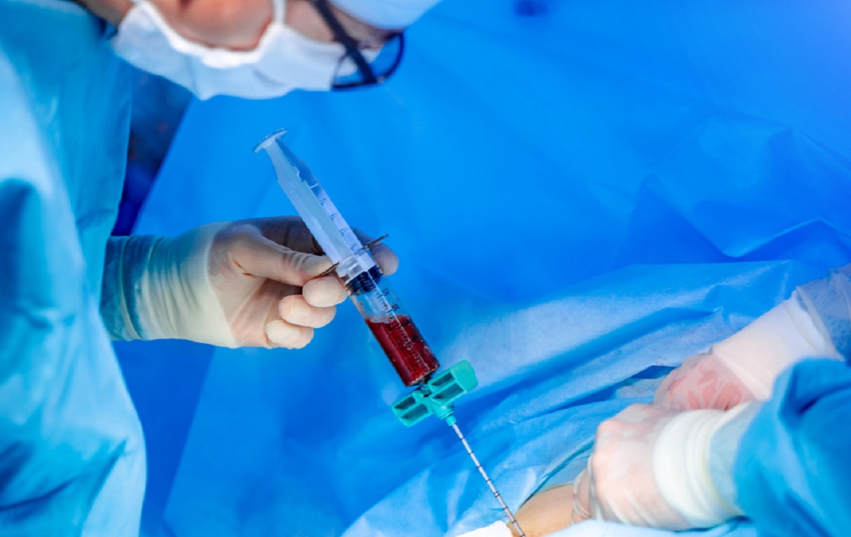 medula-osea-conoce-algunos-datos-interesantes-de-esta-curiosa-parte-del-cu-60055