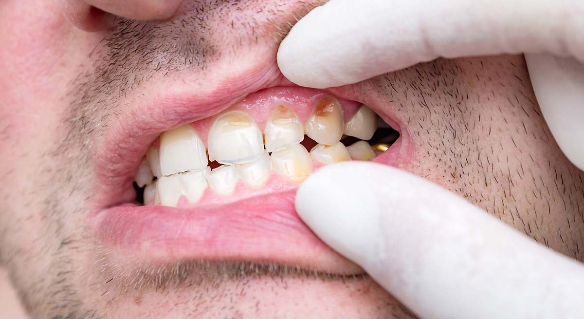 1200x655_Zumo-limon-eliminar-sarro-rapido