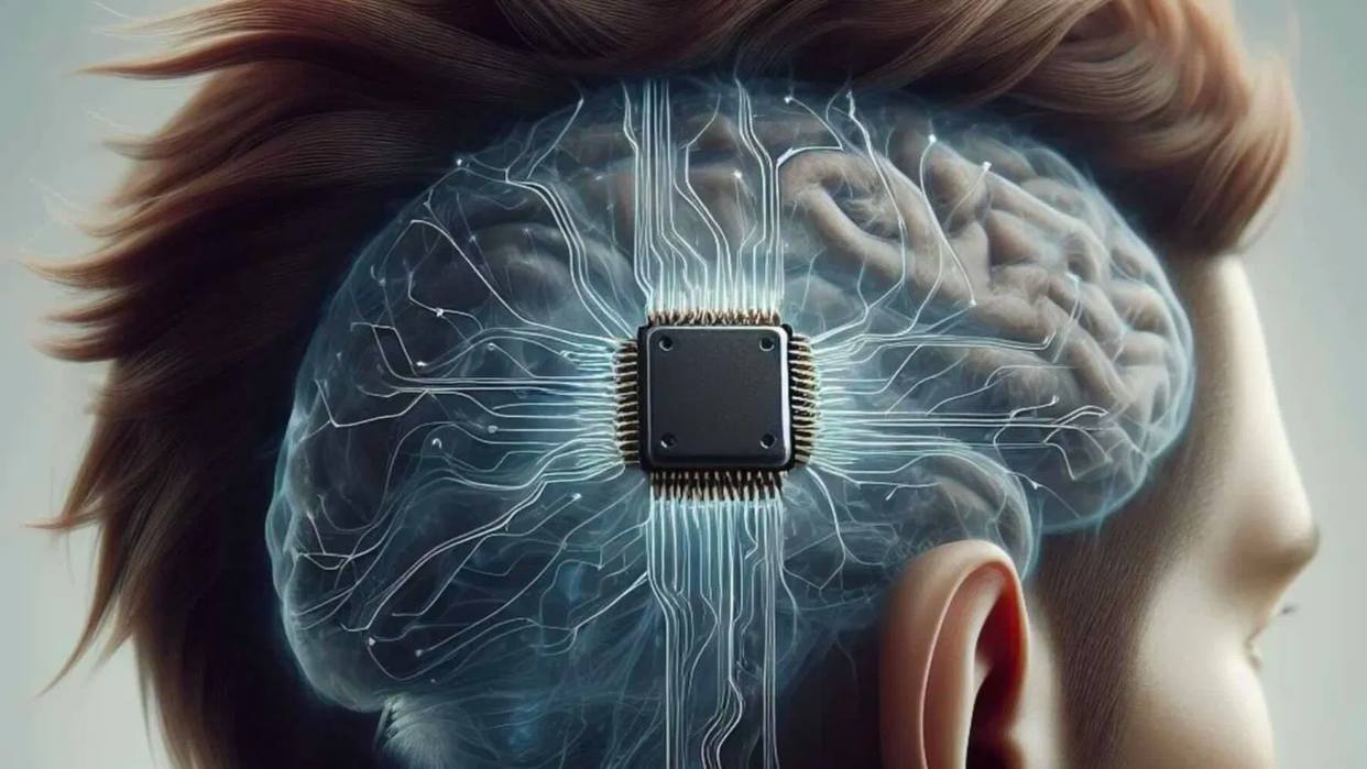 neuralink-implanta-chip-cerebral-en-una-tercera-persona-166031