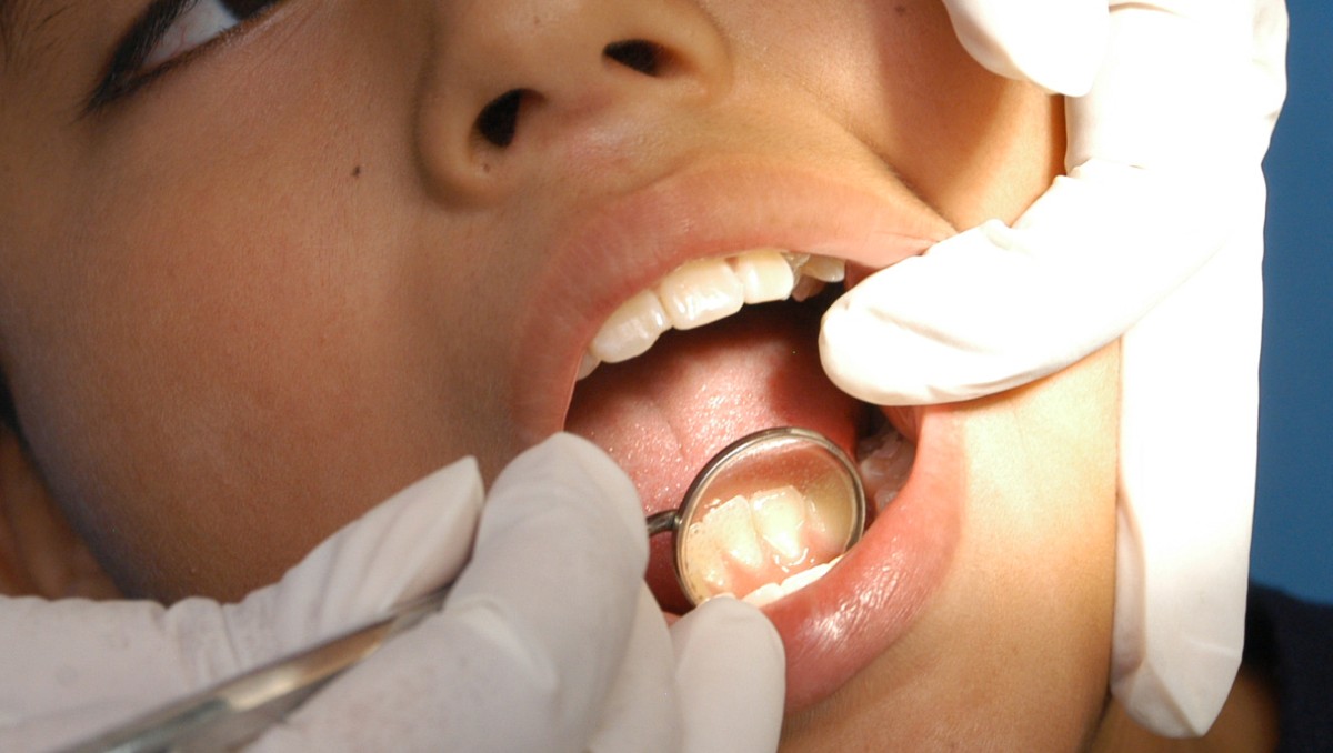 factores-riesgo-desarrollar-cancer-boca